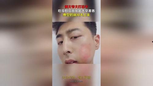 俩大爷打架吃瓜视频播放,俩大爷街头激情对决，吃瓜群众围观热议